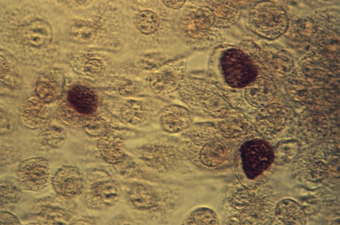 Chlamydia trachomatis