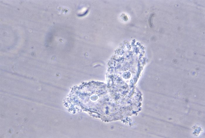 Vaginalceller covered with bacteria, Source: US Centers for Disease Control and Prevention