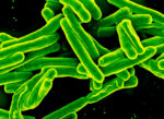 What Caused Tuberculosis