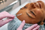 Wrinkle Treatment With Botox